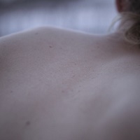 Burweed – Hide