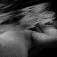 Syndrome - Floating Veins