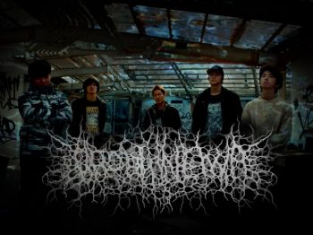 urobilinemia-band-2-e1468970735415