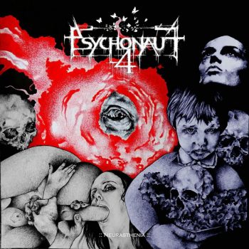 neurasthenia